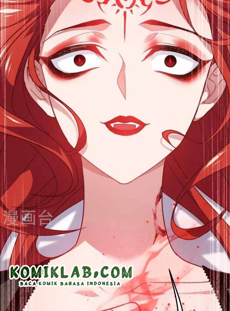 Became King After Being Bitten (Make Me The Vampire King) Chapter 21 Gambar 29