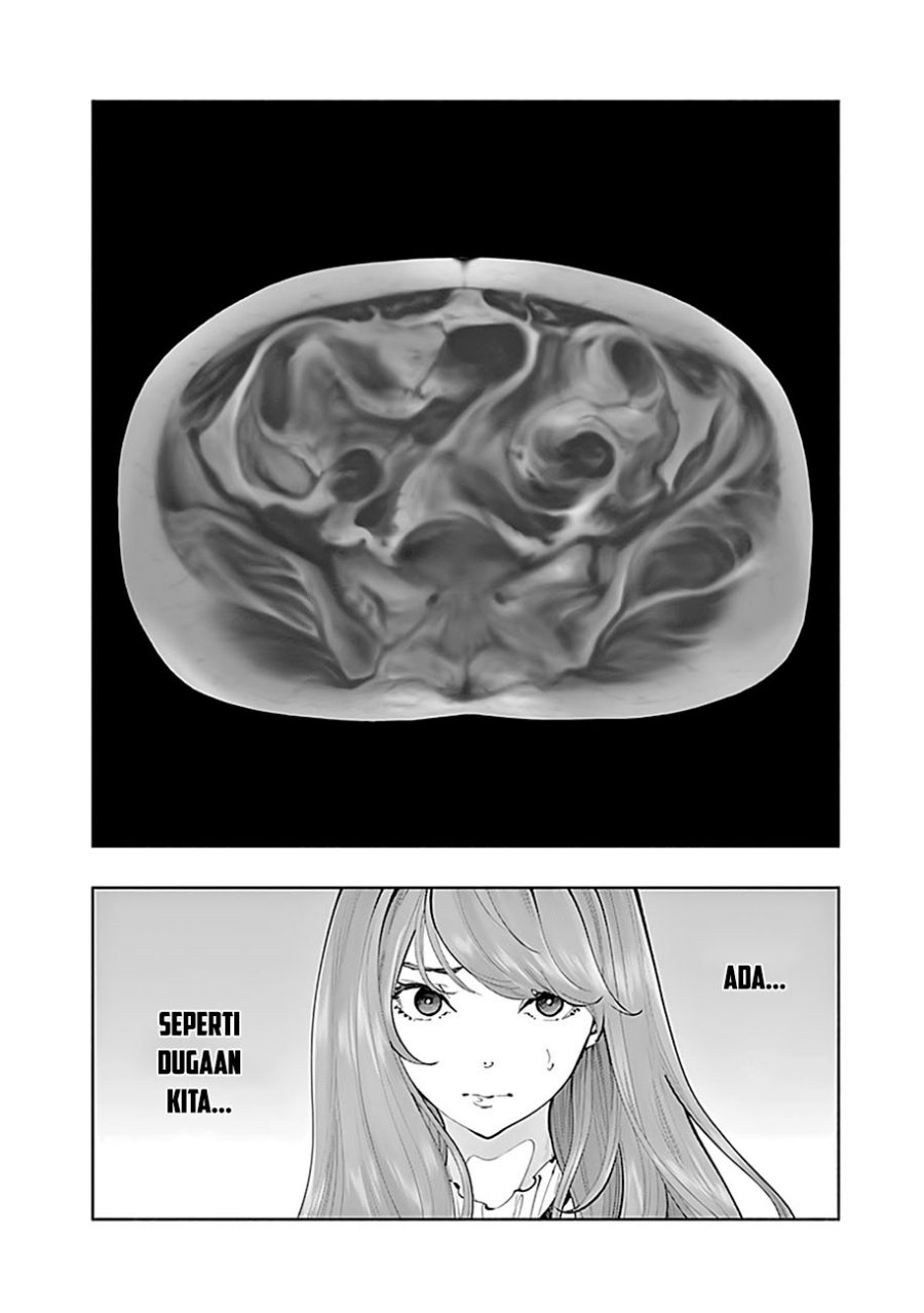 Radiation House Chapter 67 Gambar 15